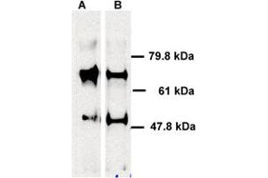 Human ABCE1 detected in immunoprecipitated samples using ABCE1 polyclonal antibody . (ABCE1 anticorps)