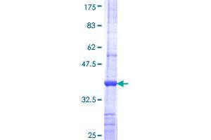 Image no. 1 for Advanced Glycosylation End Product-Specific Receptor (AGER) (AA 134-231) protein (GST tag) (ABIN1317326)