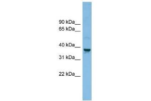 SLC30A3 antibody used at 1 ug/ml to detect target protein. (Slc30a3 anticorps)