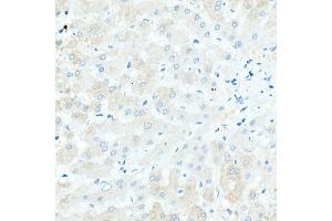 Immunohistochemistry of paraffin-embedded Human liver (negative control sample) using IGHD antibody (ABIN7267824) at dilution of 1:100 (40x lens). (IgD anticorps)