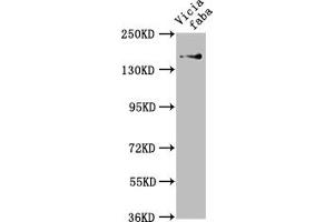anti-GLU1 (AA 106-505) antibody