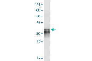 Western Blot detection against Immunogen (31.