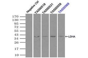 Image no. 6 for anti-Lactate Dehydrogenase A (LDHA) antibody (ABIN1499114)