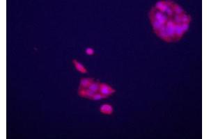 Immunofluorecence staining of anti-GPC3 Pab on HepG2 cells. (Glypican 3 anticorps  (C-Term))