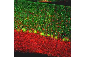 Immunofluorescent analysis of rat cerebellum section stained with chicken pAb to calbindin, ABIN8126692, dilution 1:2,000, in green, and costained with rabbit pAb to MeCP2, dilution 1:5,000, in red.