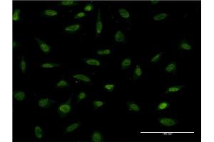 Immunofluorescence of monoclonal antibody to FOSL2 on HeLa cell.