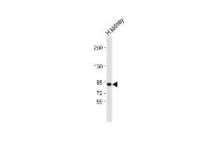 Anti-VAV3 Antibody (Cterm) at 1:2000 dilution + human kidney lysate Lysates/proteins at 20 μg per lane. (VAV3 anticorps  (C-Term))