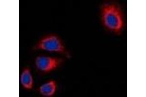 Immunofluorescent analysis of Focal Adhesion Kinase staining in HT29 cells. (FAK anticorps  (C-Term))