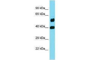 Western Blotting (WB) image for anti-Folate Hydrolase 1B (FOLH1B) (Middle Region) antibody (ABIN2436969) (FOLH1B anticorps  (Middle Region))