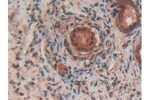 DAB staining on IHC-P; Samples: Rat Ovary Tissue