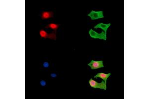ABIN7096587 and ABIN7100651 staining HepG2 cells by IF/ICC. (CTC1 anticorps)