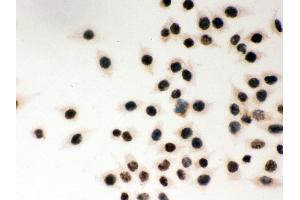 Anti- MSH2 Picoband antibody,ICC ICC: SMMC Cell