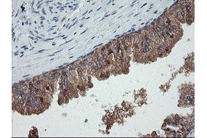 Image no. 5 for anti-Chromosome 2 Open Reading Frame 62 (C2orf62) antibody (ABIN1497054) (C2orf62 anticorps)