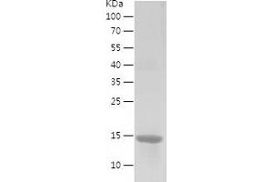 Western Blotting (WB) image for Eukaryotic Translation Initiation Factor 4E Binding Protein 2 (EIF4EBP2) (AA 1-120) protein (His tag) (ABIN7122852)