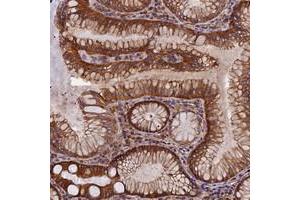 Immunohistochemical staining of human stomach with EHBP1L1 polyclonal antibody  shows strong cytoplasmic positivity in glandular cells. (EHBP1L1 anticorps)