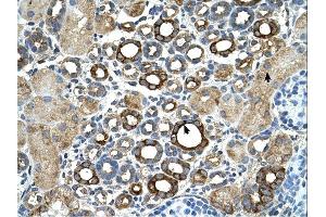 ST14 antibody was used for immunohistochemistry at a concentration of 4-8 ug/ml. (ST14 anticorps)