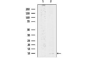Western blot analysis of lysates from Pc12, using HAMP Antibody.