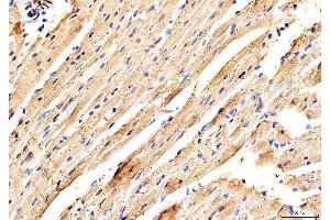 IHC analysis of MYH6 using anti-MYH6 antibody (ABIN7603070).