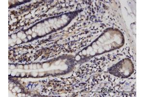 Immunoperoxidase of monoclonal antibody to HINT1 on formalin-fixed paraffin-embedded human small Intestine.