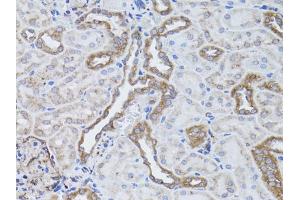 Immunohistochemistry of paraffin-embedded rat kidney using ITGAV antibody. (CD51 anticorps)