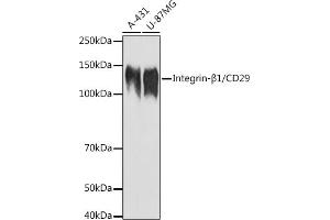 Western blot analysis of extracts of various cell lines, using Integrin-β1/CD29 antibody (ABIN6134032, ABIN6142578, ABIN6142579 and ABIN6219452) at 1:1000 dilution. (ITGB1 anticorps  (AA 600-700))