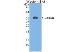 Western Blotting (WB) image for anti-Signal Transducing Adaptor Molecule (SH3 Domain and ITAM Motif) 1 (STAM) (AA 199-464) antibody (ABIN2117575) (STAM anticorps  (AA 199-464))