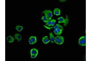 Immunofluorescence staining of MCF-7 cells with ABIN7161669 at 1:33, counter-stained with DAPI.