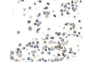 Immunocytochemistry (ICC) image for anti-CD28 (CD28) (AA 19-140) antibody (ABIN7448899) (Recombinant CD28 anticorps  (AA 19-140))