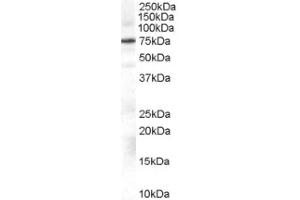 Image no. 1 for anti-Adrenergic, Beta, Receptor Kinase 1 (ADRBK1) (Internal Region) antibody (ABIN374657) (GRK2 anticorps  (Internal Region))