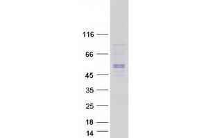 Validation with Western Blot