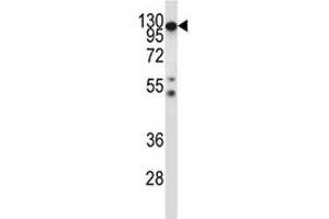 Csf1r antibody western blot analysis in mouse heart tissue lysate. (CSF1R anticorps  (AA 895-923))