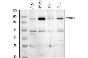 anti-Thrombospondin 2 (THBS2) (AA 637-655), (Middle Region) antibody