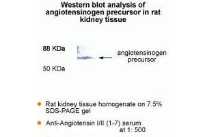 Western Blot analysis of antigiotensinogen precursor in rat kidney tissue. (AGT anticorps  (AA 1-7))