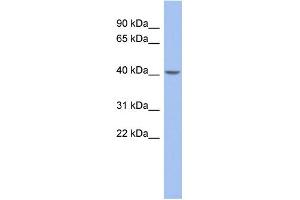 WB Suggested Anti-ZNF302 Antibody Titration:  0. (ZNF302 anticorps  (Middle Region))