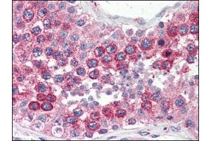 Immunohistochemistry (IHC) image for anti-Vesicle-Associated Membrane Protein 2 (Synaptobrevin 2) (VAMP2) (AA 1-89), (N-Term) antibody (ABIN317061) (VAMP2 anticorps  (N-Term))