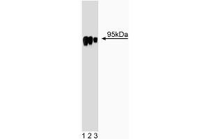 Western blot analysis of HIF-1beta on Jurkat cell lysate. (ARNT anticorps  (AA 461-574))