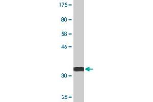 Western Blot detection against Immunogen (36. (CDC20B anticorps  (AA 416-515))
