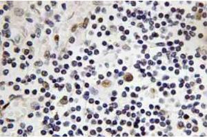 Immunohistochemistry analysis of TAL1 Antibody in paraffin-embedded human lymph node tissue. (TAL1 anticorps)
