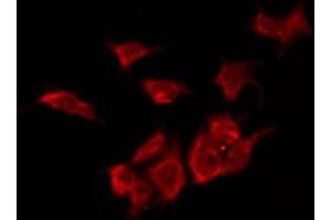 ABIN6276138 staining COLO205 by IF/ICC.