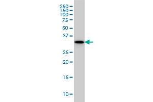 RPRD1A monoclonal antibody (M01), clone 1B8 Western Blot analysis of RPRD1A expression in A-431 .