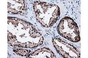 Immunohistochemistry (IHC) image for anti-Tubulin tyrosine Ligase-Like Family, Member 12 (TTLL12) antibody (ABIN1499035) (TTLL12 anticorps)