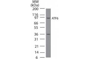 ATF6 Western Blot.