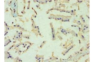 Immunohistochemistry of paraffin-embedded human prostate tissue using ABIN7152459 at dilution of 1:100 (TBL1XR1 anticorps  (AA 1-180))