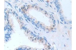 Detection of CAP3 in Human Prostate Tissue using Polyclonal Antibody to Cytoplasmic Antiproteinase 3 (CAP3)