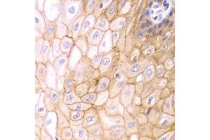 Immunohistochemistry of paraffin-embedded human esophagus using CLDN1 antibody (ABIN5971222) at dilution of 1/100 (40x lens). (Claudin 1 anticorps)
