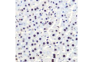 Immunohistochemistry of paraffin-embedded mouse liver using Phospho-IκBα-S36 Rabbit mAb (ABIN7268992) at dilution of 1:100 (40x lens).