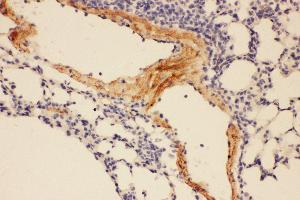 Anti-Adiponectin Picoband antibody,  IHC(P): Mouse Lung Tissue (ADIPOQ anticorps  (AA 19-244))