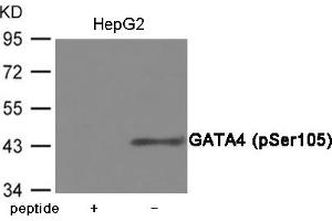 Western blot analysis of extracts from HepG2 cells using GATA4 (Phospho-Ser105) Antibody. (GATA4 anticorps  (pSer105))