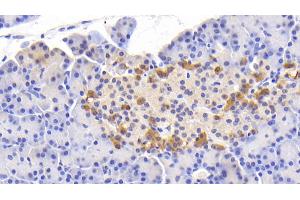 Detection of Slit2 in Human Pancreas Tissue using Polyclonal Antibody to Slit Homolog 2 (Slit2) (SLIT2 anticorps  (AA 664-777))