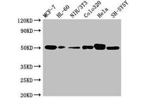 Western Blot Positive WB detected in: MCF-7 whole cell lysate, HL60 whole cell lysate, NIH/3T3 whole cell lysate, Colo320 whole cell lysate, Hela whole cell lysate, SH-SY5Y whole cell lysate All lanes: CALR antibody at 2 μg/mL Secondary Goat polyclonal to rabbit IgG at 1/10000 dilution Predicted band size: 49 kDa Observed band size: 49 kDa (Calreticulin anticorps  (AA 18-417))
